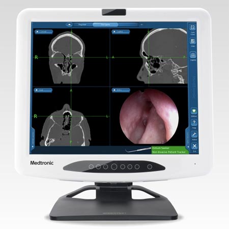 2 7mm storz endoscope