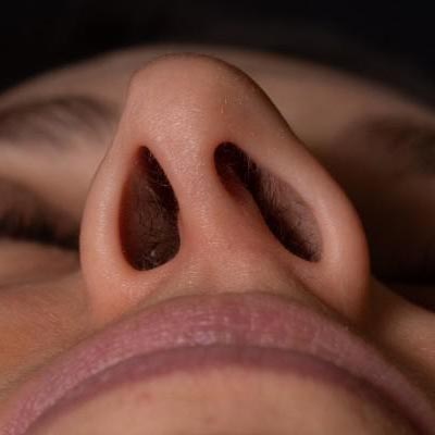 Deviated Nasal Septum treatment in Miyapur